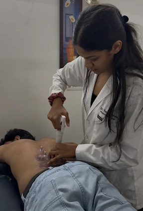 Dry Needling Treatment